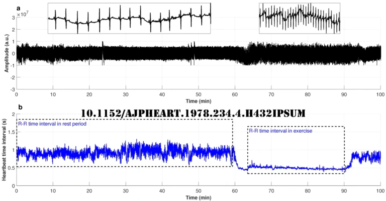 10.1152/ajpheart.1978.234.4.h432